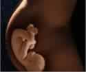 Gineco-obstetricia
